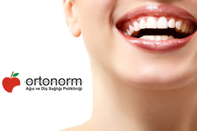 Diş Beyazlatma - Ortonorm Ortodonti