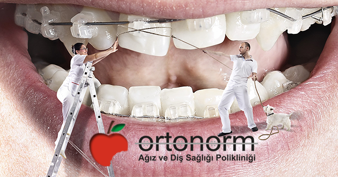 Ortodontik Bozukluğu Engellemek