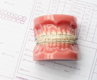 Ortodonti Tedaviye Başlamak için Yapılması Gereken İşlemler