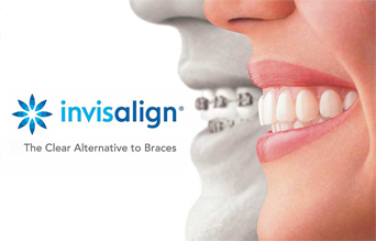 Ortonorm Ortodonti - Invisalign