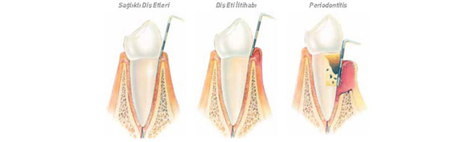 Ortonorm Periodontoloji